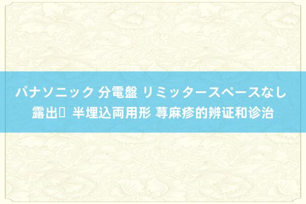 パナソニック 分電盤 リミッタースペースなし 露出・半埋込両用形 荨麻疹的辨证和诊治